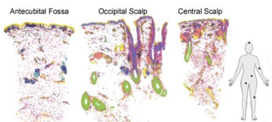 Spatial human skin atlas accepted in Nature Genetics
